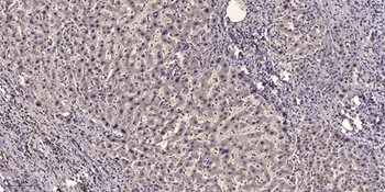 NCAM2 antibody