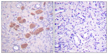 p40-phox (phospho-Thr154) antibody