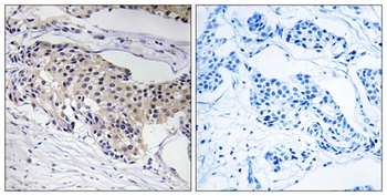 NDUFA3 antibody