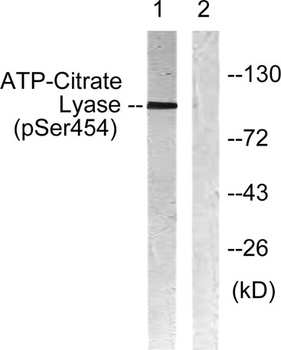ATP-citrate synthase (phospho-Ser455) antibody