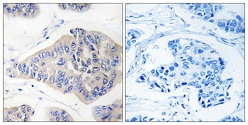 NDUFS1 rabbit pAb Antibody