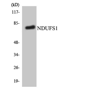 NDUFS1 rabbit pAb Antibody