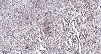 Septin 2 antibody