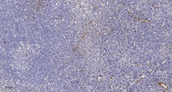 Ribosomal Protein L10A antibody