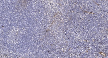 Ribosomal Protein L10A rabbit pAb