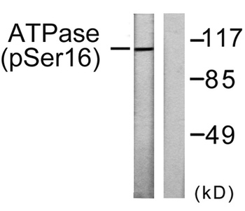 Na+/K+-ATPase alpha1 (phospho-Ser16) antibody