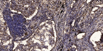 Neuro D (phospho Ser274) rabbit pAb
