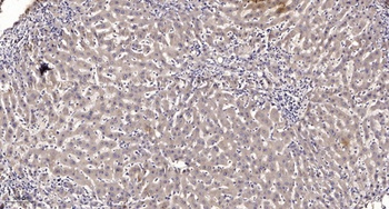 Neuro D antibody