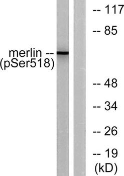 NF2 (phospho-Ser518) antibody
