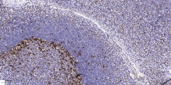 NF2 (phospho Ser518) rabbit pAb