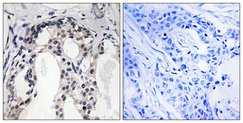 NF2 (phospho Ser10) rabbit pAb