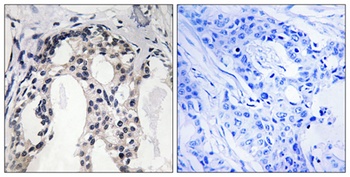 NF2 (phospho-Ser10) antibody