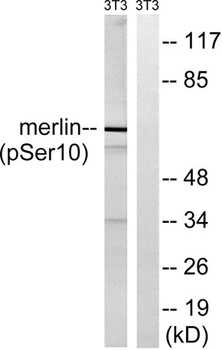 NF2 (phospho Ser10) rabbit pAb