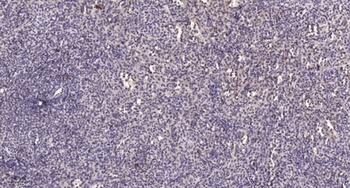 NF-1 antibody