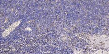 NFATc4 (phospho Ser676) rabbit pAb