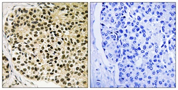 NFATc4 (phospho Ser168/S170) rabbit pAb