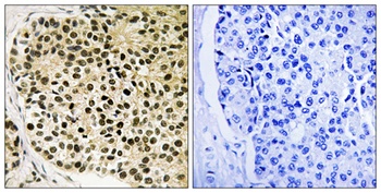 NFATc4 (phospho-Ser168/S170) antibody