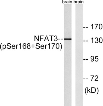 NFATc4 (phospho-Ser168/S170) antibody