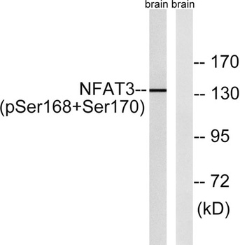 NFATc4 (phospho Ser168/S170) rabbit pAb