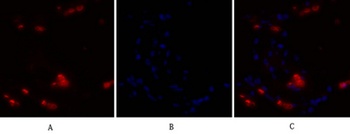 NF kappa B-p105/p50 antibody