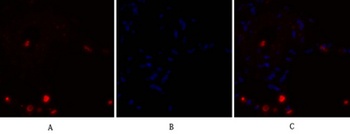 NF kappa B-p105/p50 antibody