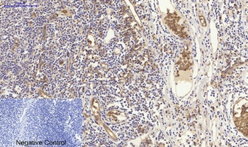 NF kappa B-p105/p50 antibody