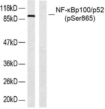 NFκB-p100 (phospho Ser865) rabbit pAb