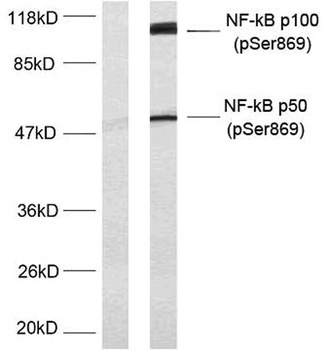 NFκB-p100 (phospho Ser869) rabbit pAb