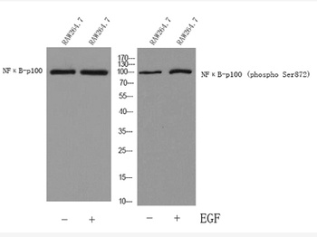 NFκB-p100 (phospho Ser872) rabbit pAb