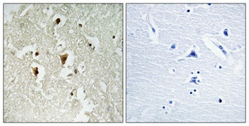 IκB-β (phospho Thr19) rabbit pAb