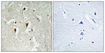 I kappa B-beta (phospho-Thr19) antibody