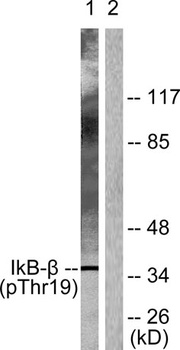 IκB-β (phospho Thr19) rabbit pAb