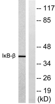 I kappa B-beta antibody