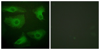 I kappa B-Epsilon (phospho-Ser22) antibody