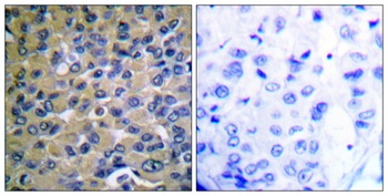 I kappa B-Epsilon (phospho-Ser22) antibody