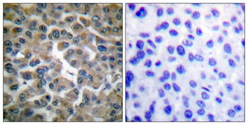 IκB-ε rabbit pAb