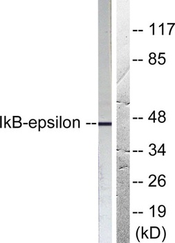 I kappa B-Epsilon antibody