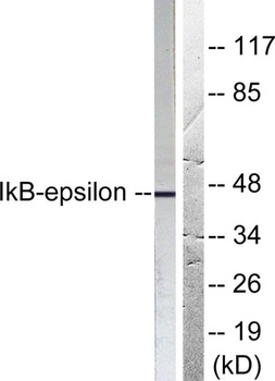 IκB-ε rabbit pAb