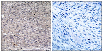 IRP-1 (phospho Ser711) rabbit pAb