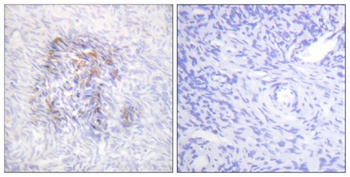 IRP-1 (phospho Ser138) rabbit pAb