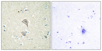 NK-TR rabbit pAb