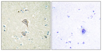 NK-TR antibody