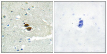 NOS1 (phospho Ser852) rabbit pAb