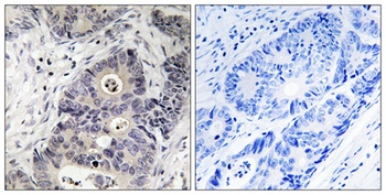 NOS2 (phospho-Tyr151) antibody