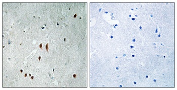 CNOT2 (phospho Ser101) rabbit pAb