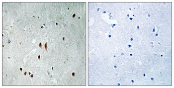 CNOT2 (phospho-Ser101) antibody