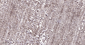 CNOT2 rabbit pAb