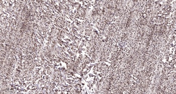 CNOT2 antibody