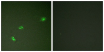 B23 (phospho Thr199) rabbit pAb