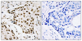 B23 (phospho Thr199) rabbit pAb